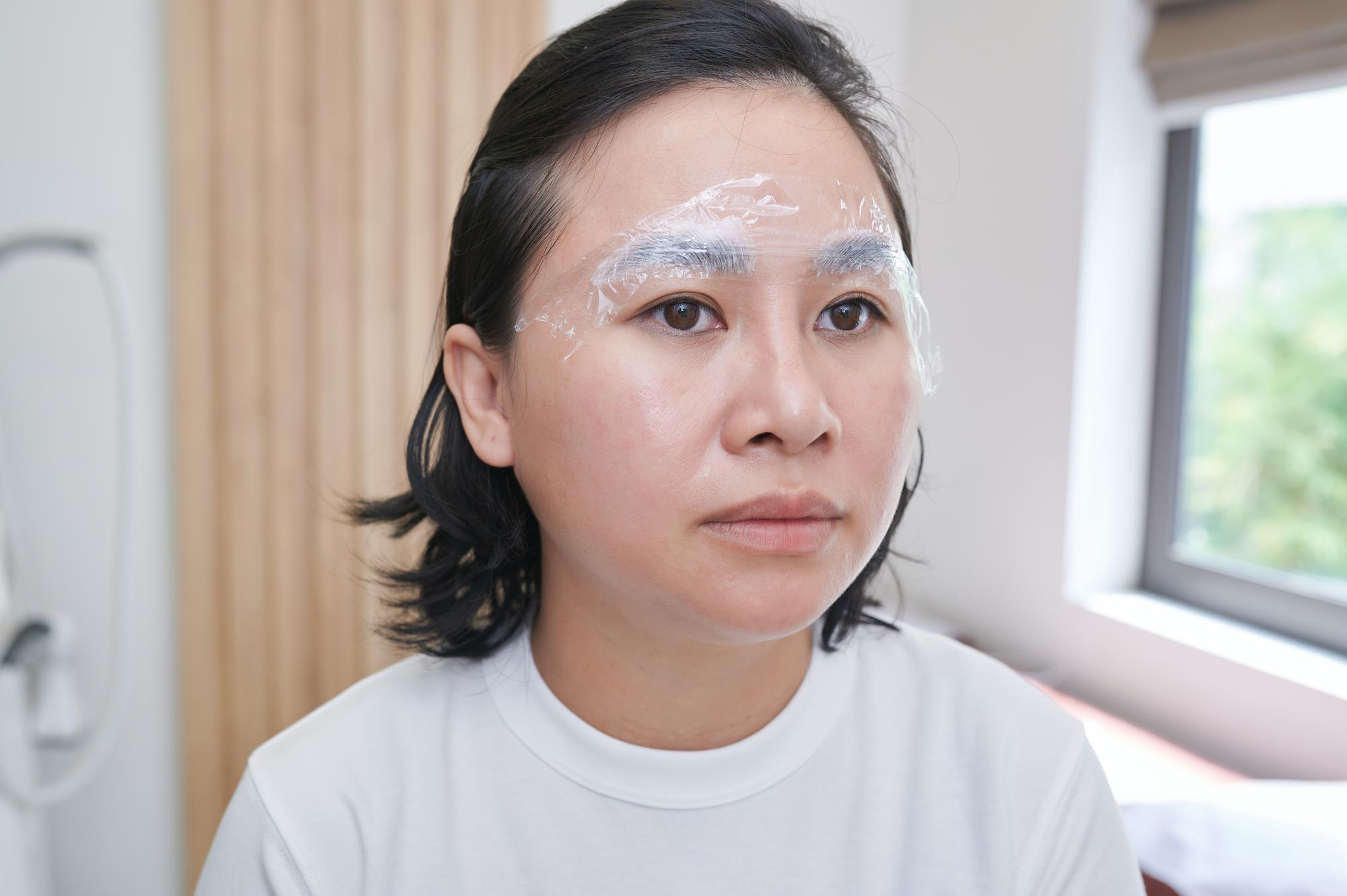 白斑不會傳染！別再用刺青遮了，醫師教你正確治療方式